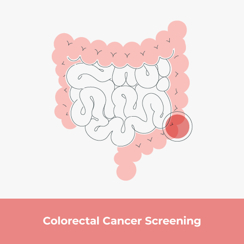FIT or FOBT: Which is Better Screening Test for Colorectal Cancer?